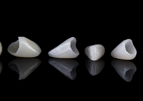 Close up of dental crowns on black reflective surface