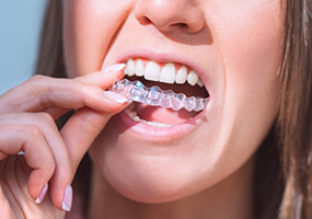 Woman putting in Invisalign aligners in Austin