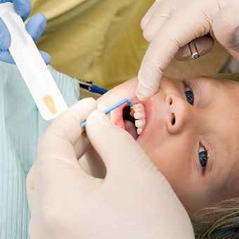 Child receiving fluoride treatment