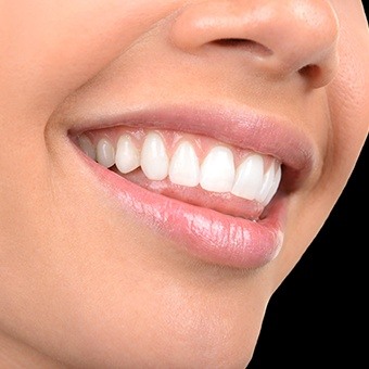 Closeup of smile with straight white teeth